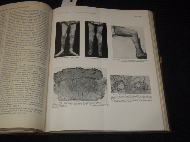 1916 JOHNS HOPKINS HOSPITAL BULLETIN BOUND VOLUME NO. 27 - KD 5403K