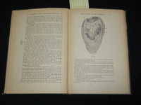 1895 ON DISEASES OF THE VERMIFORM APPENDIX HARDCOVER BOOK BY HAWKINS - KD 7359