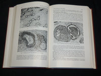 1956 DISEASES OF THE BREAST HARDCOVER BOOK BY C. D. HAAGENSE M. D. - KD 2761E