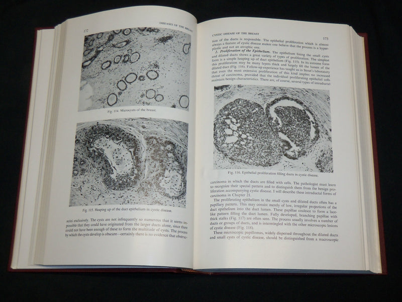 1956 DISEASES OF THE BREAST HARDCOVER BOOK BY C. D. HAAGENSE M. D. - KD 2761E