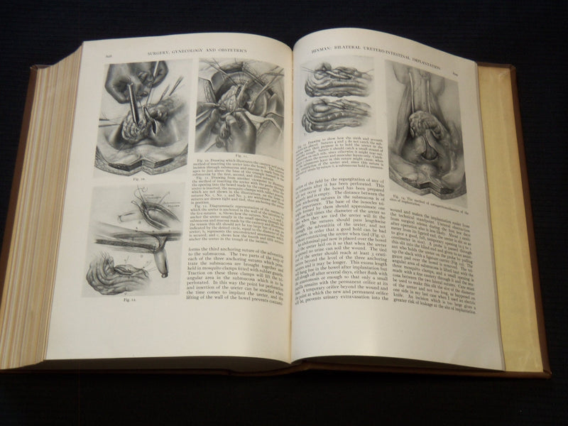 1935 JUL-DEC SURGERY, GYNECOLOGY AND OBSTETRICS MAGAZINE BOUND VOLUME -KD 4784B
