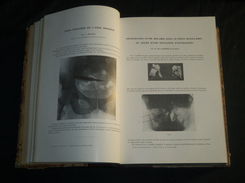 1932-1938 JOURNAL DE RADIOLOGIE ET D'ELECTROLOGIE BOUND VOLUMES LOT OF 6 - KD 6