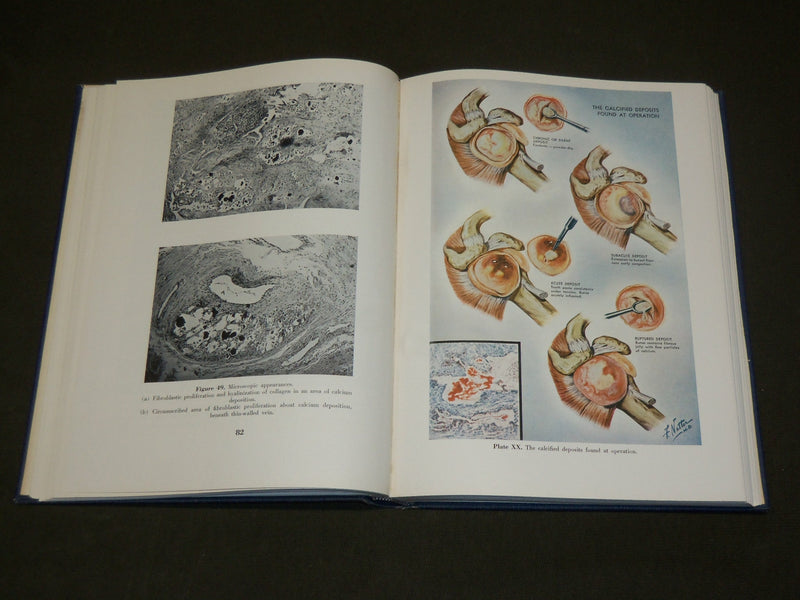 1953 SHOULDER LESIONS HARDCOVER BOOK BY H. F. MOSELEY - KD 6138