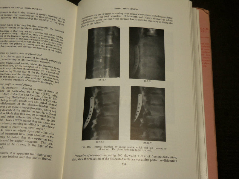 1959 DISEASES OF THE VERTEBRAL COLUMN BOOK EDITED BY NASSIM & BURROWS - KD 6052
