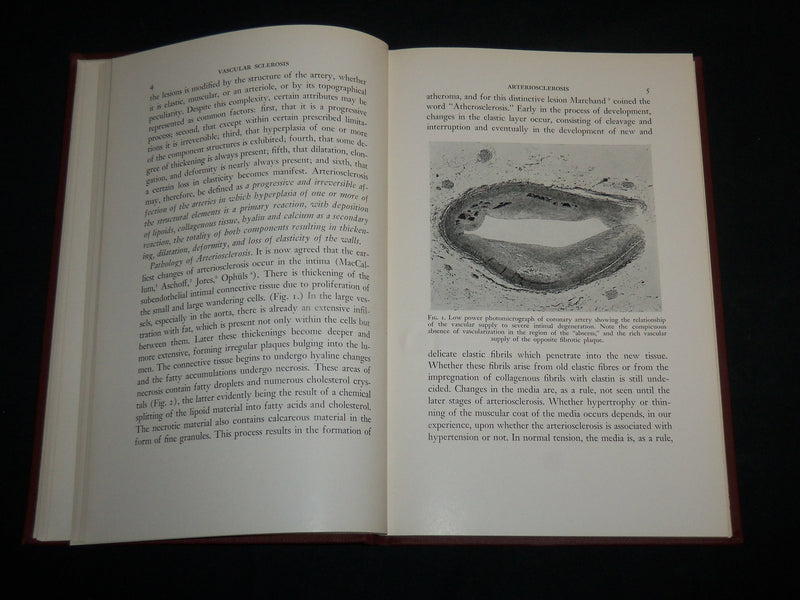 1942 VASCULAR SCLEROSIS HARDCOVER BOOK BY ELI MOSCHCOWITZ - KD 7193