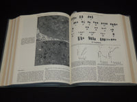 1987 JULY-AUGUST CANCER RESEARCH MAGAZINE BOUND VOLUME - 4 ISSUES - KD 6132O