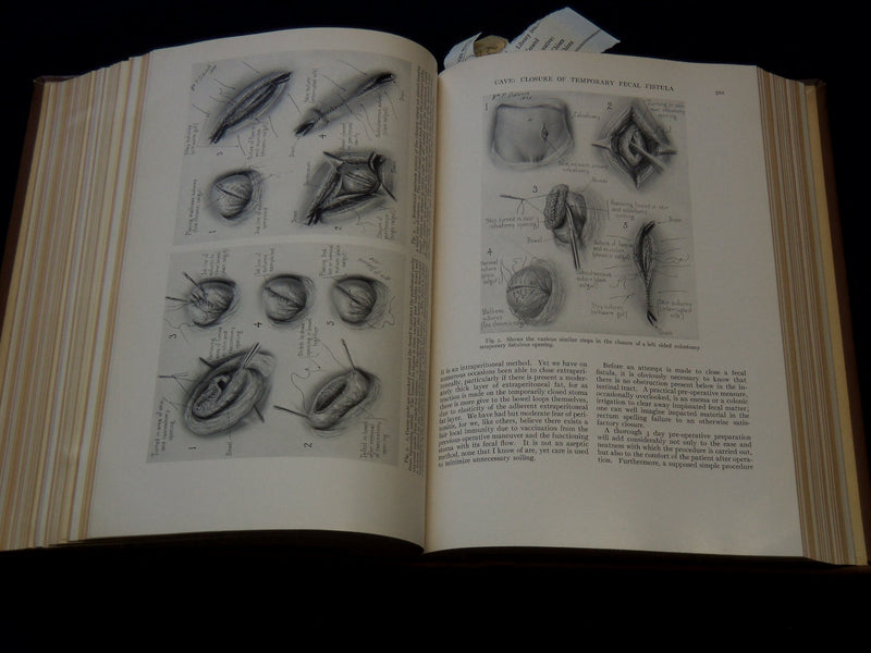 1935 JUL-DEC SURGERY, GYNECOLOGY AND OBSTETRICS MAGAZINE BOUND VOLUME -KD 4784B