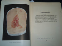 1913 PORTFOLIO OF DERMOCHROMES BY JEROME KINGSBURY VOLUMES 1-3 - KD 986