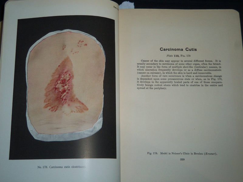 1913 PORTFOLIO OF DERMOCHROMES BY JEROME KINGSBURY VOLUMES 1-3 - KD 986