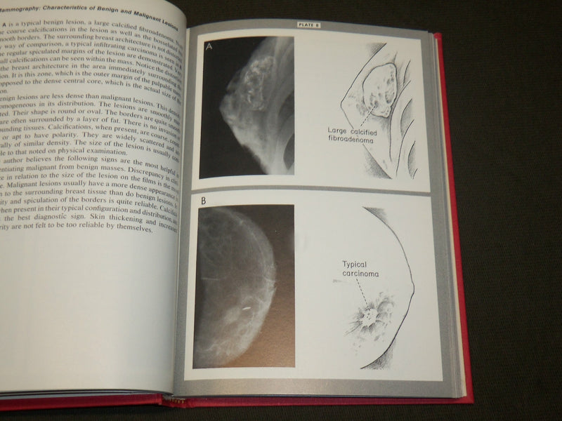 1968 SURGERY OF THE BREAST BOOK BY SOUTHWICK SLAUGHTER & HUMPHREY- KD 6073