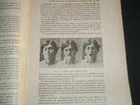 1910-1919 ANNALES D'OCULISTIQUE MAGAZINE LOT OF 60 + 4 VOLUMES - R 1106