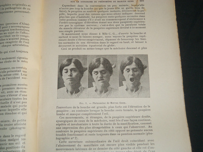 1910-1919 ANNALES D'OCULISTIQUE MAGAZINE LOT OF 60 + 4 VOLUMES - R 1106