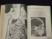 1973 X-RAYING THE PHARAOHS HARDCOVER BOOK BY JAMES HARRIS & KENT WEEKS - KD 8276