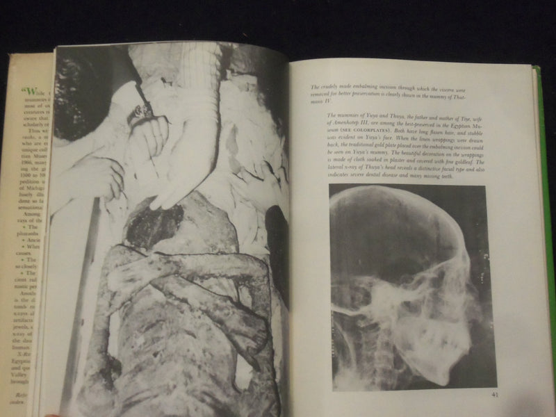 1973 X-RAYING THE PHARAOHS HARDCOVER BOOK BY JAMES HARRIS & KENT WEEKS - KD 8276