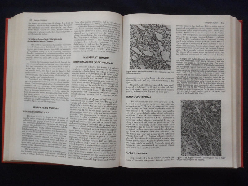1984 PATHOLOGIC BASIS OF DISEASE HARDCOVER BOOK - ROBBINS-COTRAN-KUMAR - KD 8892