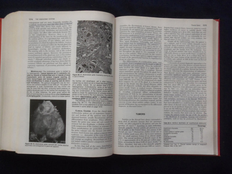 1984 PATHOLOGIC BASIS OF DISEASE HARDCOVER BOOK - ROBBINS-COTRAN-KUMAR - KD 8892