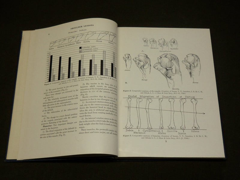 1953 SHOULDER LESIONS HARDCOVER BOOK BY H. F. MOSELEY - KD 6138