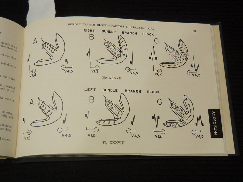 1952 P-Q-R-S-T ELECTROCARDIOGRAM GUIDE BOOK - RISEMAN - 3RD EDITION - K 2691