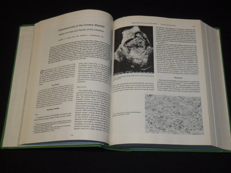 1982-1988 CANCER JOURNAL MAGAZINE BOUND VOLUMES LOT OF 6 - KD 1I