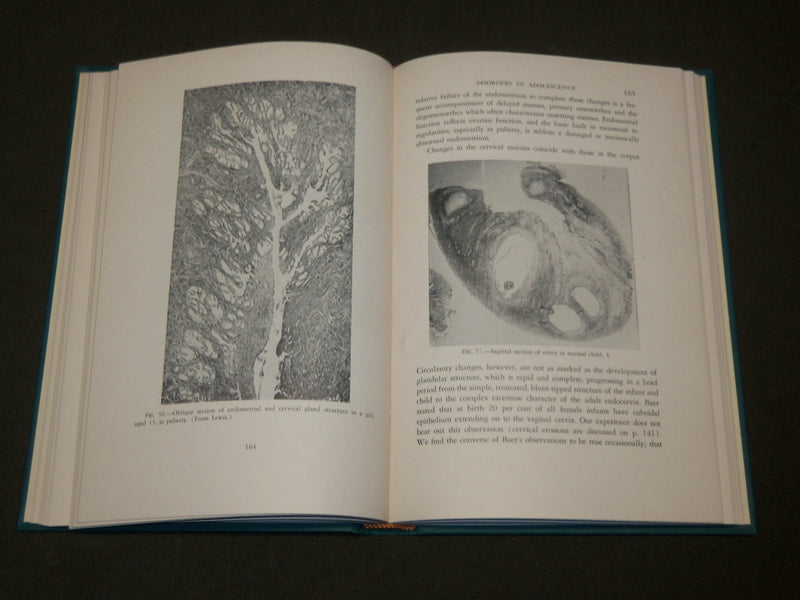 1953 PEDIATRIC GYNECOLOGY HARDCOVER BOOK BY GOODRICH C. SCHAUFFLER - KD 6114