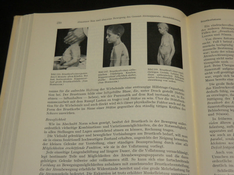 1956 ATEMHEILKUNST GERMAN HARDCOVER BOOK BY LUDWIG SCHMITT - KD 2767Z
