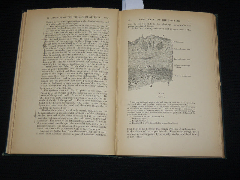 1895 ON DISEASES OF THE VERMIFORM APPENDIX HARDCOVER BOOK BY HAWKINS - KD 7359
