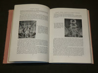 1959 DISEASES OF THE VERTEBRAL COLUMN BOOK EDITED BY NASSIM & BURROWS - KD 6052