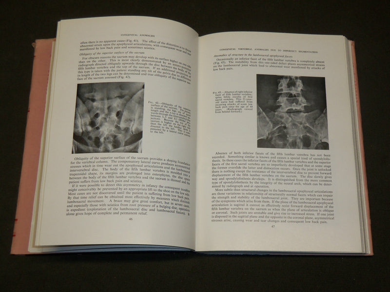 1959 DISEASES OF THE VERTEBRAL COLUMN BOOK EDITED BY NASSIM & BURROWS - KD 6052