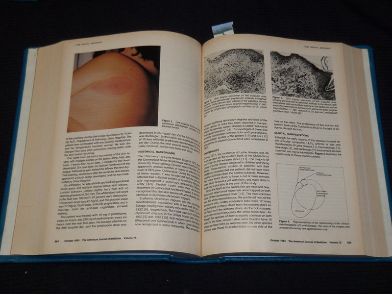 1983-1986 AMERICAN JOURNAL OF MEDICINE & SUPPLEMENTS VOLUMES LOT OF 7 - KD 1B