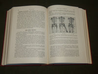 1955 THE BACK AND ITS DISK SYNDROMES BOOK BY PHILIP LEWIN M. D. - KD 6288