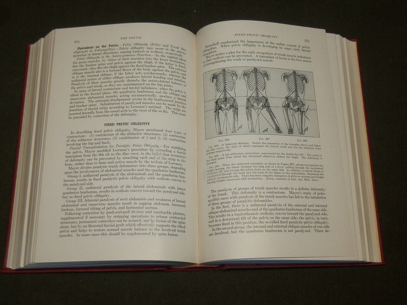 1955 THE BACK AND ITS DISK SYNDROMES BOOK BY PHILIP LEWIN M. D. - KD 6288