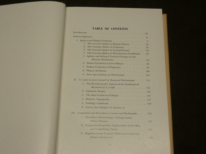 1958 VASCULAR SPIDERS AND RELATED LESIONS BOOK BY WILLIAM BENNETT BEAN - KD 6263