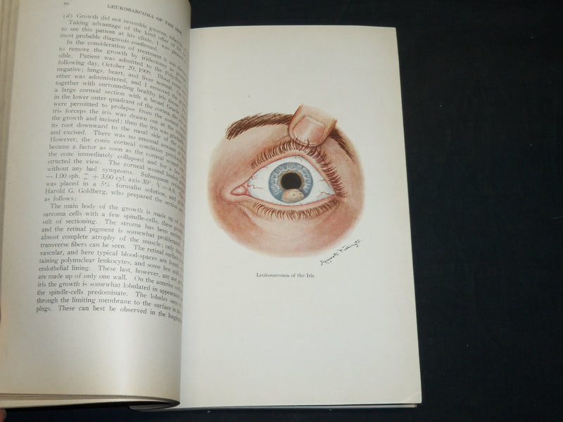 1911-1914 ANNALS OF OPHTHALMOLOGY MAGAZINE LOT OF 8 ISSUES - WR 106M