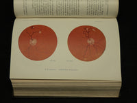 1906-1922 ANNALES D'OCULISTIQUE FRENCH VOLUMES LOT OF 8 - NICE PLATES - KD 21E