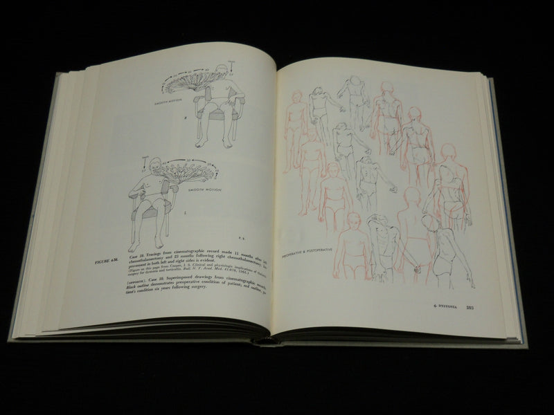 1969 INVOLUNTARY MOVEMENT DISORDERS HARDCOVER BOOK BY IVRING COOPER - R 712O