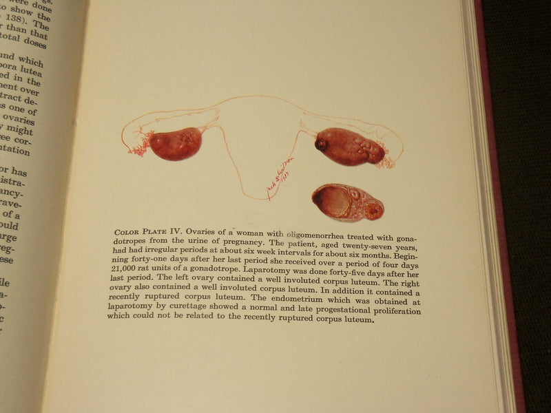 1939 ENDOCRINE GYNECOLOGY BOOK BY E. C. HAMBLEN, M. D. - KD 6134