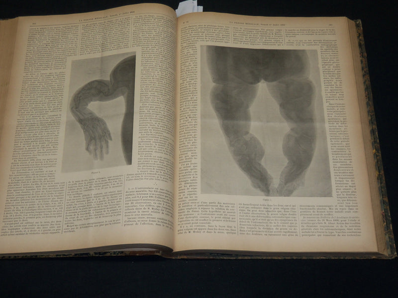 1899 JANUARY-JULY LA PRESSE MEDICALE JOURNAL FRENCH BOUND VOLUME - KD 5904