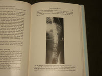 1961 DISEASES OF THE INTERVERTEBRAL DISC BOOK BY REUBEN RABINOVITCH MD - KD 6271