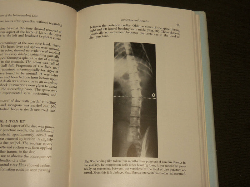 1961 DISEASES OF THE INTERVERTEBRAL DISC BOOK BY REUBEN RABINOVITCH MD - KD 6271