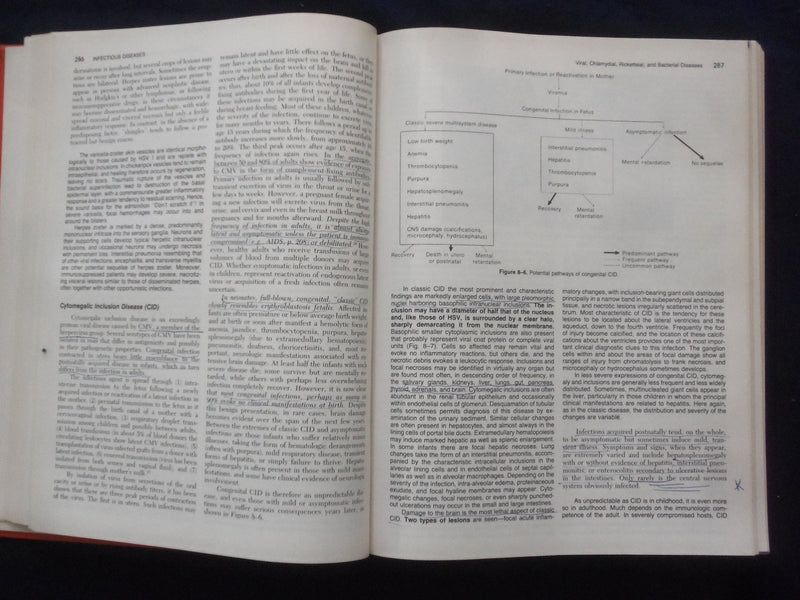 1984 PATHOLOGIC BASIS OF DISEASE HARDCOVER BOOK - ROBBINS-COTRAN-KUMAR - KD 8892