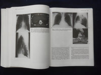 1992 CURRENT SURGICAL THERAPY HARDCOVER BOOK -4TH ED. -JOHN CAMERON MD.- KD 8894