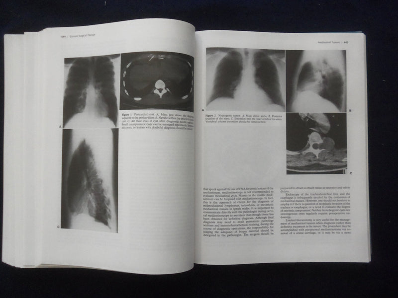 1992 CURRENT SURGICAL THERAPY HARDCOVER BOOK -4TH ED. -JOHN CAMERON MD.- KD 8894