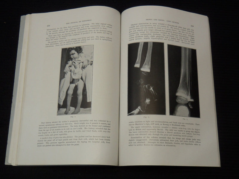 1937-1938 THE JOURNAL OF PEDIATRICS LOT OF 2 ISSUES - K 2627