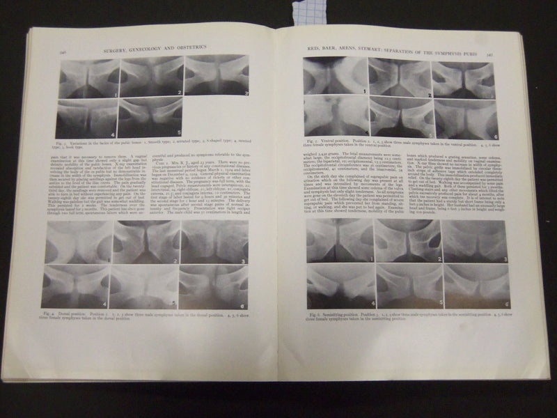 1932 SEPTEMBER SURGERY, GYNECOLOGY AND OBSTETRICS SOFTCOVER BOOK - J 5244