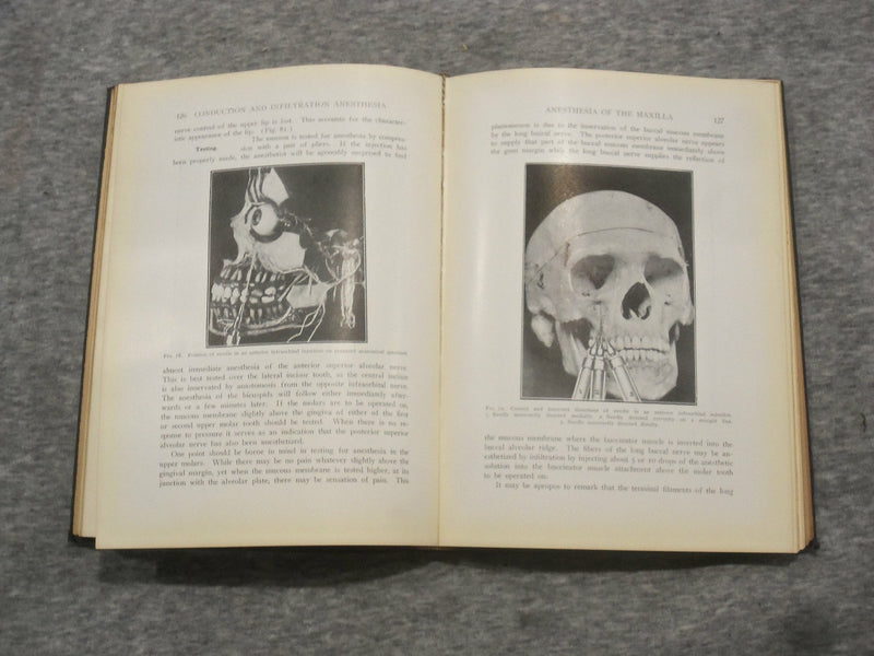 1923 CONDUCTION AND INFILTRATION ANESTHESIA BY MENDEL NEVIN - KD 2758Q