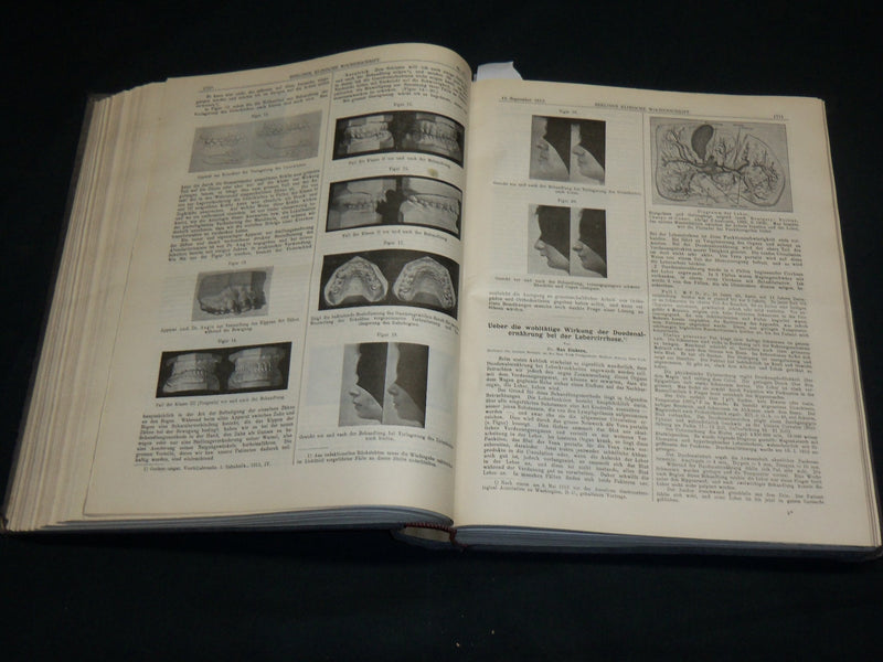1913 JUL-DEC BERLINER KLINISCHE WOCHENSCHRIFT MAGAZINE BOUND VOLUME - R 490