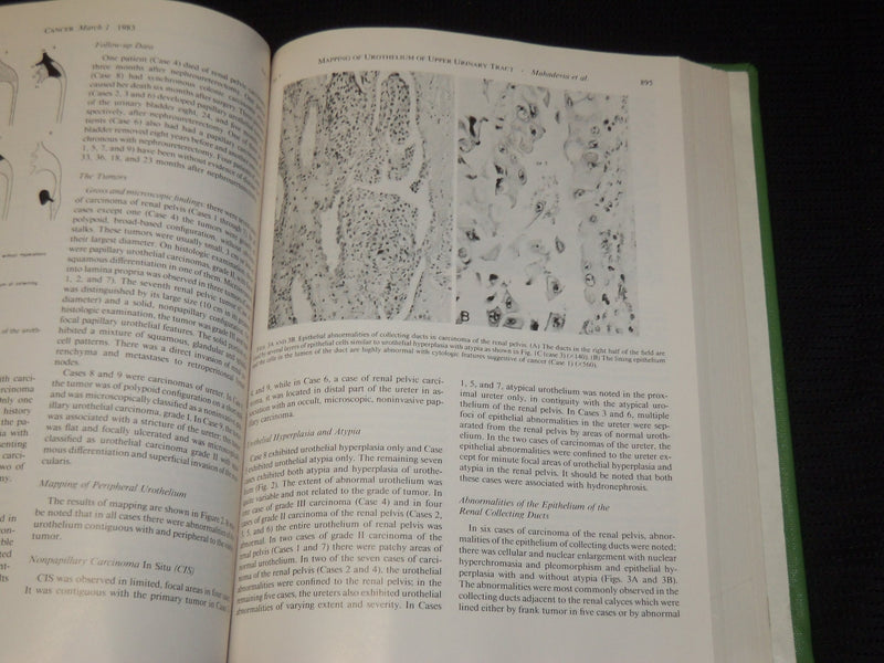 1982-1988 CANCER JOURNAL MAGAZINE BOUND VOLUMES LOT OF 6 - KD 1I