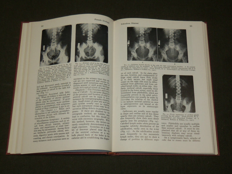 1969 FEMALE UROLOGY HARDCOVER BOOK BY DRS. RIDLEY & EVERETT - KD 6265
