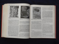 1984 PATHOLOGIC BASIS OF DISEASE HARDCOVER BOOK - ROBBINS-COTRAN-KUMAR - KD 8892
