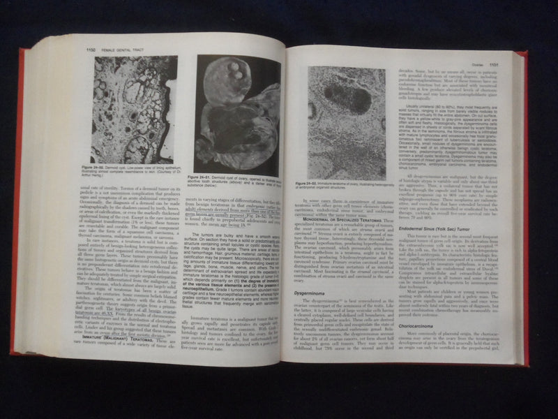 1984 PATHOLOGIC BASIS OF DISEASE HARDCOVER BOOK - ROBBINS-COTRAN-KUMAR - KD 8892
